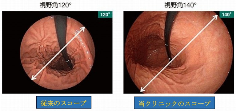 最新細径内視鏡