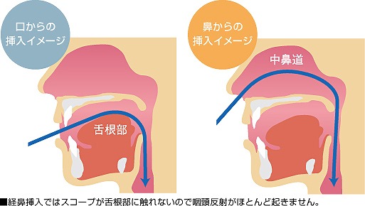 辛くない胃カメラを心がけています